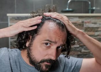 মাথার চুল ঝরে পড়া কি থামানো সম্ভব?