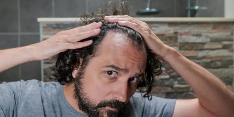 মাথার চুল ঝরে পড়া কি থামানো সম্ভব?