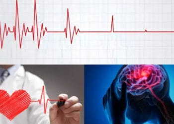 শরীরে কোন বিষয়গুলো ঘটলে মানুষ হঠাৎ মারা যায়?