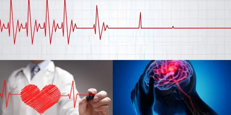 শরীরে কোন বিষয়গুলো ঘটলে মানুষ হঠাৎ মারা যায়?