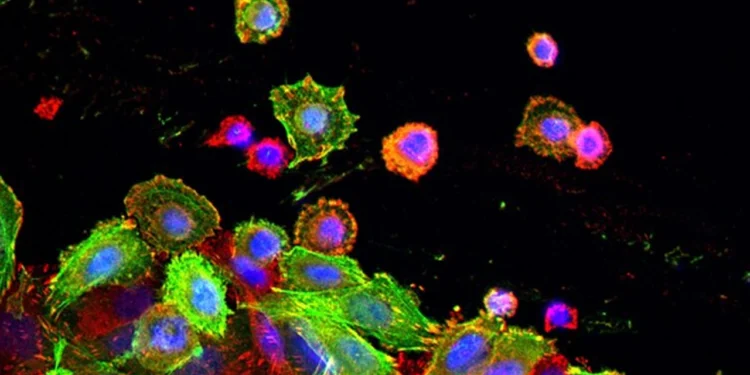 ক্যানসার থেকে বাঁচুন ব্যায়াম করে