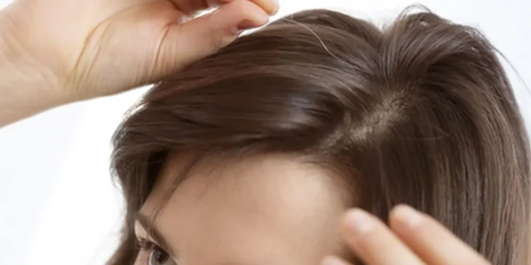 অপ্রাপ্ত বয়সে চুলে পাক ধরলে করণীয়