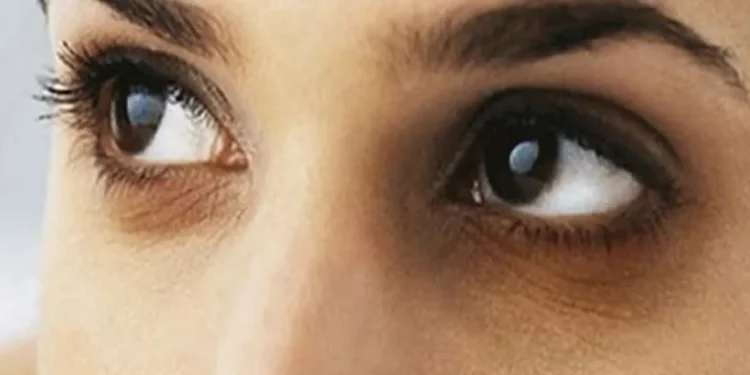 চোখের নিচে কালো দাগ দূর হবে ৩ সবজিতে