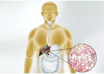 ‘মেটাবলিক অ্যাসোসিয়েটেড ফ্যাটিলিভার’ এক নীরব ঘাতক