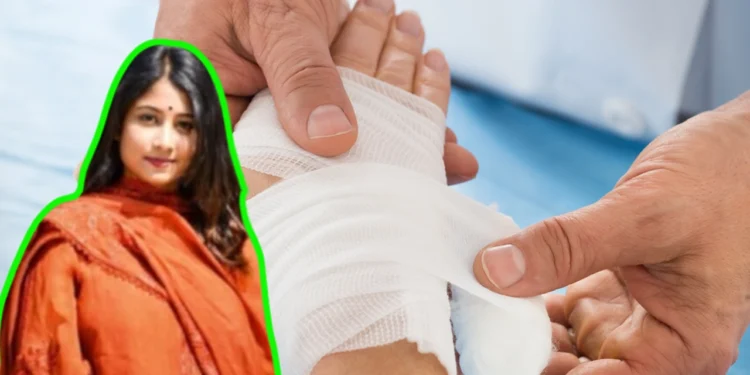 অগ্নিদগ্ধ রোগীরা যেমন খাবার খাবে, কী বলছেন পুষ্টিবিদ