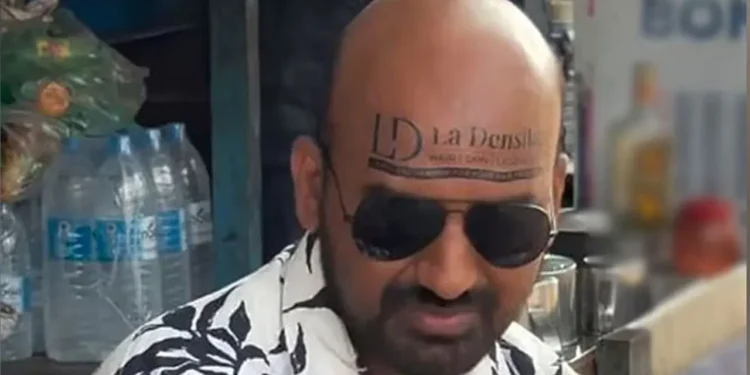 টাক মাথায় বিলবোর্ড বানিয়ে মোটা অঙ্কের আয়