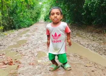 ২৮ ইঞ্চিতে আটকে আছেন ১৮ বছর বয়সী তৌহিদ