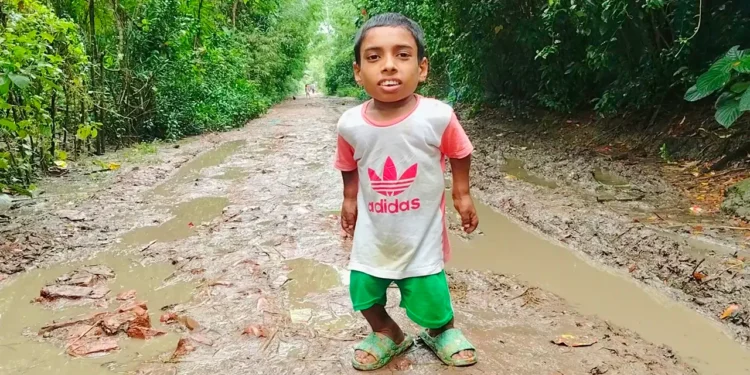 ২৮ ইঞ্চিতে আটকে আছেন ১৮ বছর বয়সী তৌহিদ