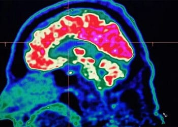 ভারতে ‘মস্তিষ্কখেকো’ অ্যামিবার সংক্রমণে ১৯ জনের মৃত্যু