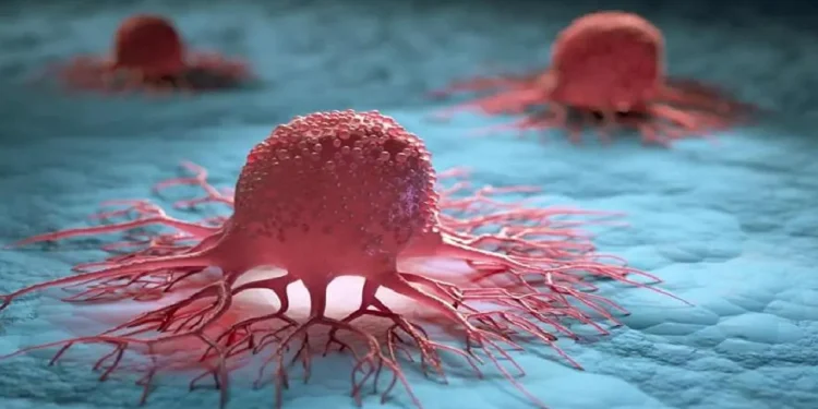 শরীরের যে ১০ লক্ষণ ক্যানসারের ইঙ্গিত দেয়