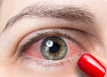 মাঝে মাঝেই ঝাপসা দেখছেন? চোখ ক্যানসারের লক্ষণ কি না জেনে নিন