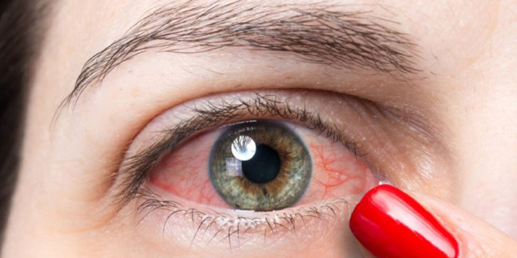 মাঝে মাঝেই ঝাপসা দেখছেন? চোখ ক্যানসারের লক্ষণ কি না জেনে নিন