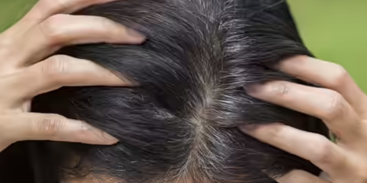 অল্প বয়সেই চুল পাকলে এই ৫ খাবার রাখুন প্রতিদিনের তালিকায়