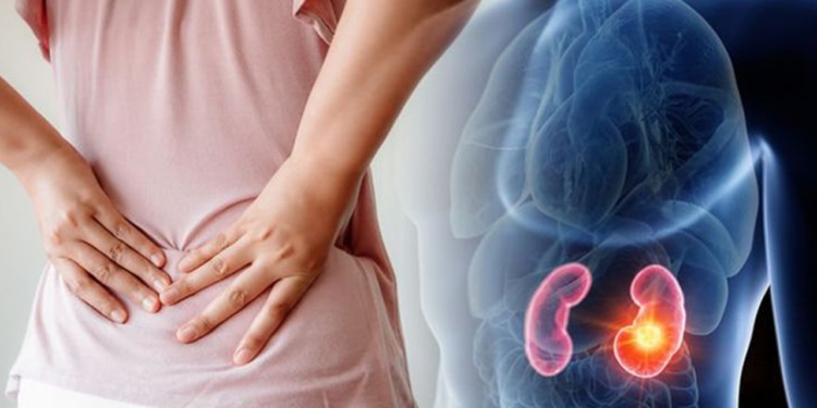 কিডনি খারাপ হওয়ার আগে সংকেত দেয় চোখ, যে ৫ লক্ষণে বুঝবেন