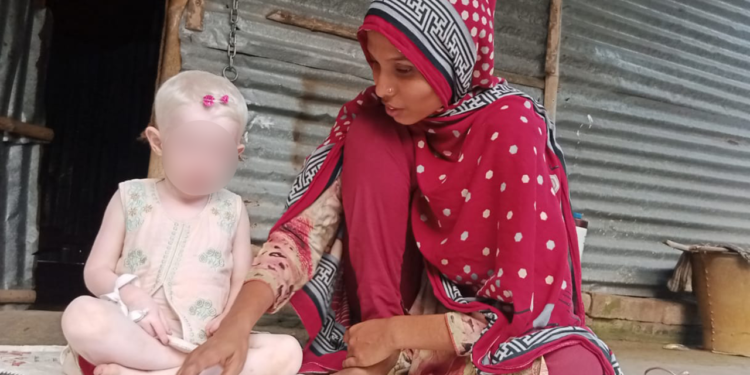 সন্তানের গায়ের রঙ ‘ভিন্ন’ হওয়ায় স্ত্রীকে তালাক