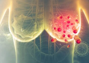 ব্রেস্ট ক্যানসার: জানুন কোন স্টেজে কী হয়