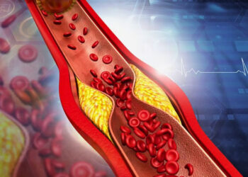 কোলেস্টেরল বাড়ার ইঙ্গিত দেবে যে অঙ্গ