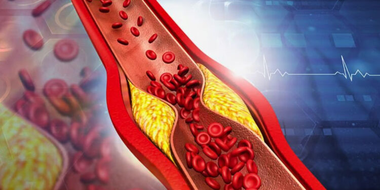 কোলেস্টেরল বাড়ার ইঙ্গিত দেবে যে অঙ্গ