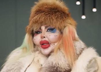 নিজের চেহারা সুন্দর করতে ৩৮৮ বার প্লাস্টিক সার্জারি