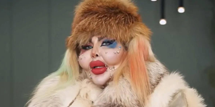 নিজের চেহারা সুন্দর করতে ৩৮৮ বার প্লাস্টিক সার্জারি