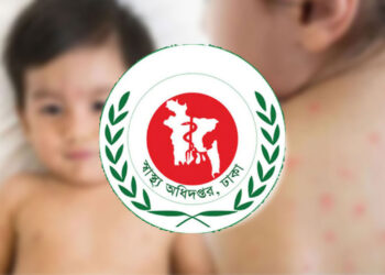 হাম ও উপসর্গে দেশে ২৪ ঘণ্টায় ১৭ শিশুর মৃত্যু