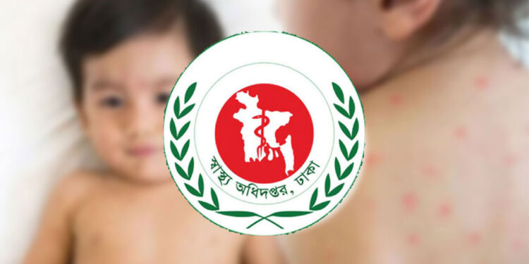 হাম ও উপসর্গে দেশে ২৪ ঘণ্টায় ১৭ শিশুর মৃত্যু