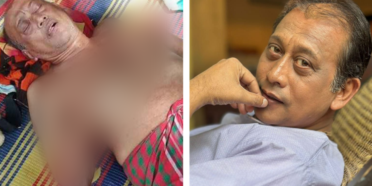 সমু চৌধুরীর চিকিৎসার সব খরচ বহন করবে অভিনয়শিল্পী সংঘ